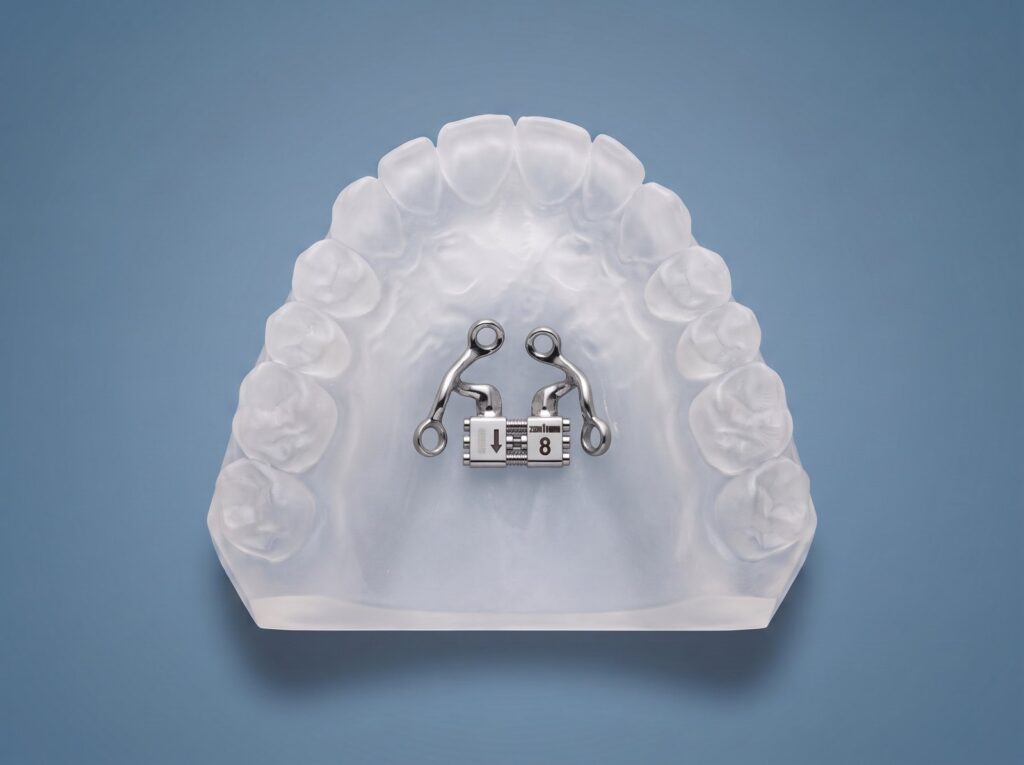 TAD Expander