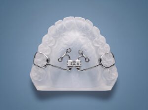 TAD Expander, Bone and Tooth-Borne