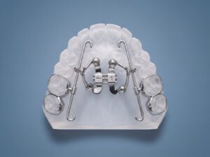 TAD Expander + with protraction facemask hooks