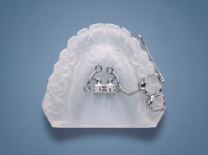 TAD Expander + with intrusion arch